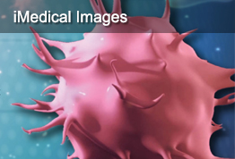 iMedical Images
