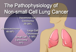 The Pathophysiology of Non-small Cell Lung Cancer (NSCLC)